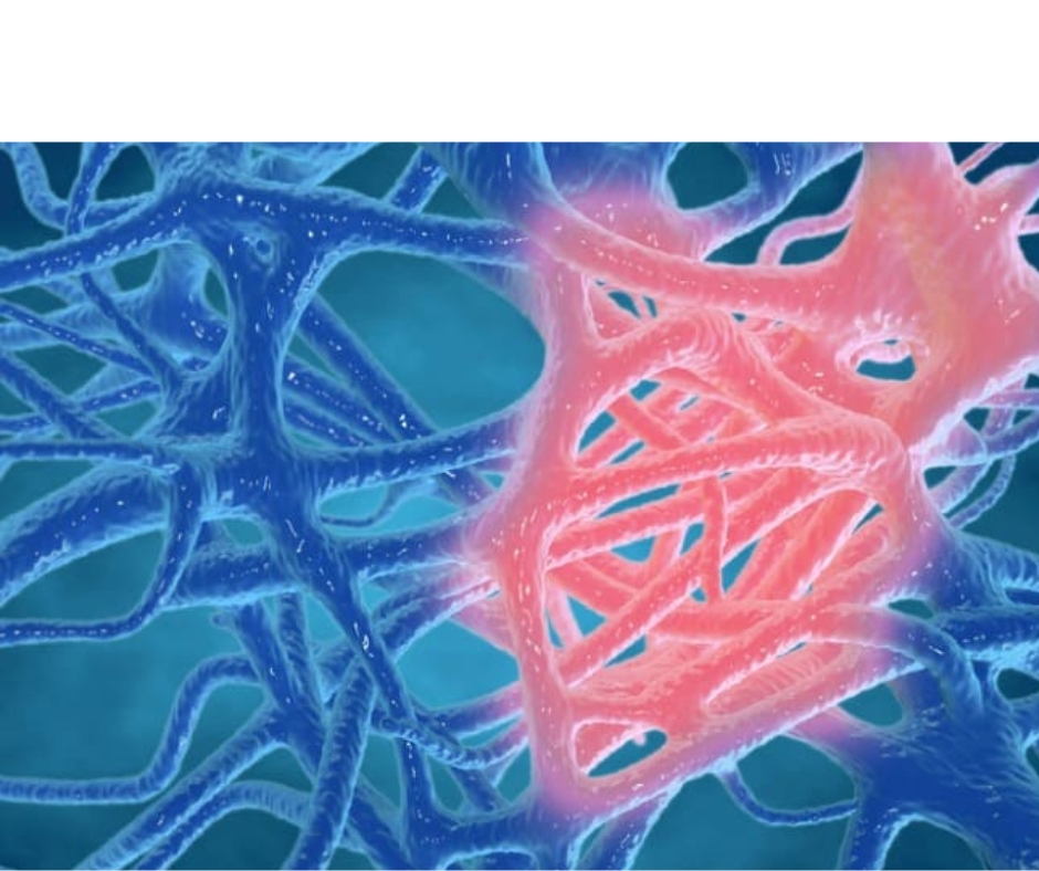 Inflamación Celular